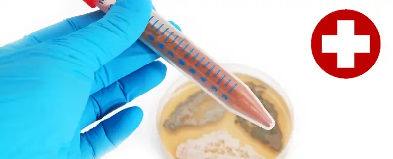 schimmelprotektor_schimmel-im-haus_luftfeuchtigkeit_schimmelentfernung_schimmelgutachten_solingen_blog_F-53812509-Olha-Rohulya-Mon-M